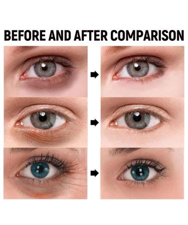 Anti-Aging Eye Cream with Retinol - Moisturizing 15g for Dark Circles & Fine Lines - All Skin Types - Buy Online on GoSupps.com