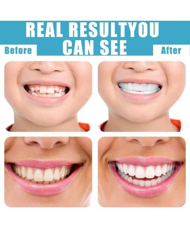 Buy 2 Pair Brightening Dentures - Cosmetic Veneers Teeth Set for Men & Women - Fake Teeth & Braces for Instant Smile Makeover - Buy Online on GoSupps.com