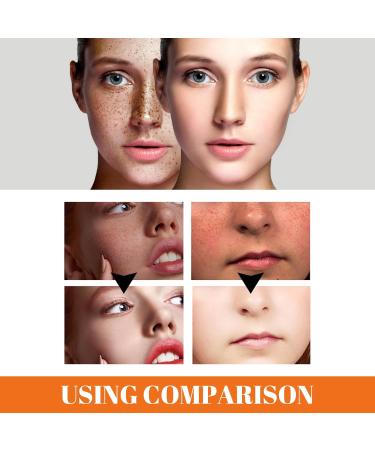 BAInuai Papaya Whitening Cream Brightening Cream Skin Whitening Cream Papaya Whitening Cream for face day cream and night cream against freckles armpit whitening cream pack of 2 - Buy Online on GoSupps.com