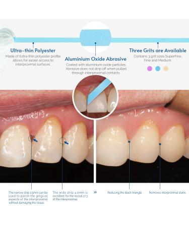 Natureaqua Harz Tooth Polishing Strips - 2.5mm Blue Dental Grinding Paper 6m Roll | Interdental Polishing Tool for Effective Tooth Care - Buy Online on GoSupps.com