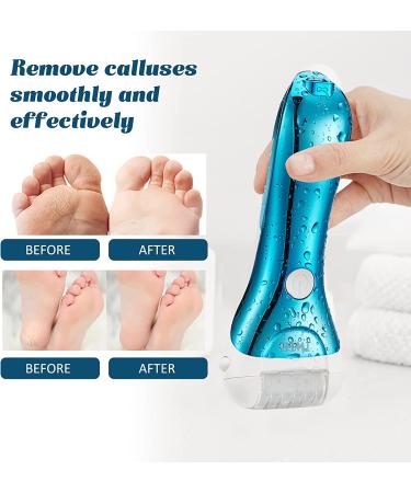Electric Callus Remover - Rechargeable Foot Scrubber with 5 Roller Heads | Waterproof Pedicure Kit for Cracked Heels | Chromed Blue - Buy Online on GoSupps.com