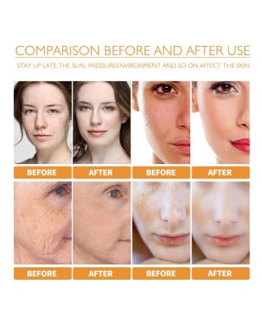 Turmeric Dark Spot Corrector Serum for Face - Natural Dark Spot Remover for Acne, Hyperpigmentation, and Smooth Skin - Moisturizing Tumeric Oil - 2 PCS - Buy Online on GoSupps.com