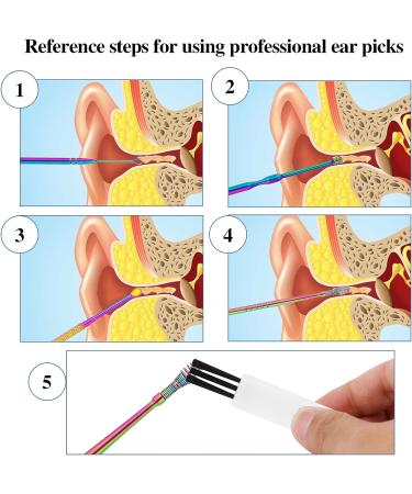 6Pcs Professional Double-Headed Ear Wax Removal Kit with Spiral Remover - Includes Storage Box and Cleaning Brush - Buy Online on GoSupps.com