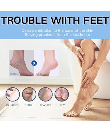 IZBEAUVO Urea Foot Cream Cracked Heel Repair Cream Cracked Heel Stick foot cream for calluses Foot Cream for Cracked Heels and Dry Skin Deep Moisturizing Hydrates and Softens Dry Feet Knees Hand - Buy Online on GoSupps.com