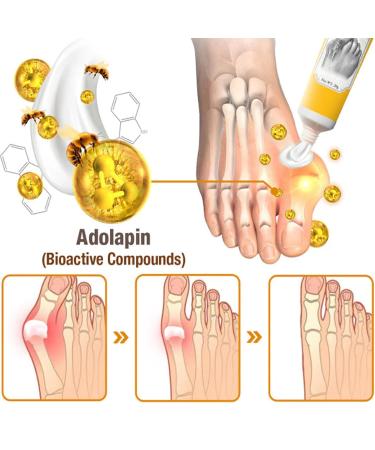 HalluxWell BeeVenom Cream Hallux Care Bee Venom Cream 3Pcs - Buy Online on GoSupps.com