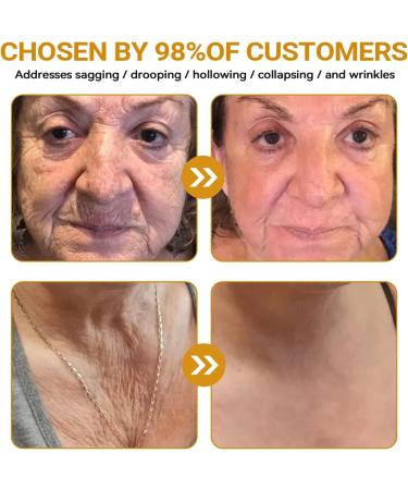  PHFTRCEW VLSVLS Expecting Cremes Experience Huid rearsing & Therapy Cremes VLSVLS Type Cremes Natural Executives Hide Types - Buy Online on GoSupps.com