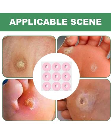 Eoixuqba Corn Removers for Toes - Corn Patches Foot Toes | Adhesive Foot Care Cushions Waterproof Corn Protectors Corn Patches for Foot Toes Gentle Support for Feet Women Men - Buy Online on GoSupps.com