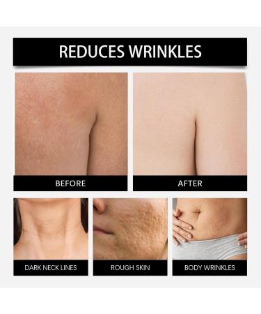 Anti Aging Vitamin E Body Moisturizer Professional Massage Cream Long Absorption | Firming Cream | Natural Formulation | Advanced Firming & Wrinkle-Reducing Cream 100ml (1) - Buy Online on GoSupps.com