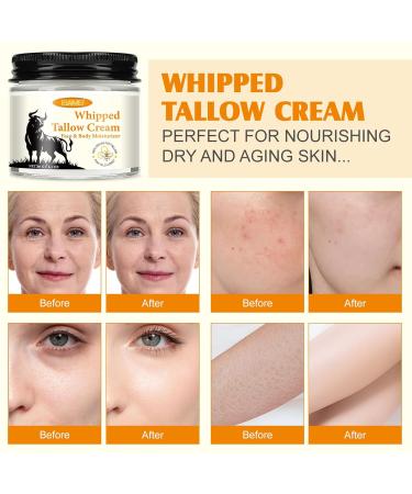 Beef Tallow for Skin Tallow Face Moisturizer Organic Grass-Fed Grass Finished Beef Tallow and Honey Balm Deeply Moisturizing for Face & Body 2.1 oz 2.1 Ounce (Pack of 1) - Buy Online on GoSupps.com