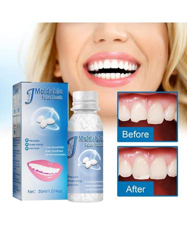 2023 Tooth Fix Kit 30ml - Moldable Thermal Fitting Beads for Temporary Teeth Replacement - DIY Heat Fit Beads for Restoring Your Confident Smile - Buy Online on GoSupps.com