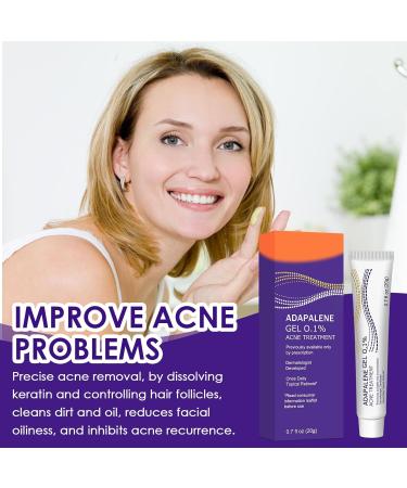 Halercay 20g acne cream reduces the volume of pimples effectively improves pimples on the face removes acne for pimpleprone skin makes the skin look smooth - Buy Online on GoSupps.com