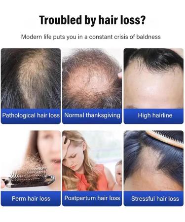 behound DrShangguan AntiHair Loss Shampoo Consciousney Antihair Loss and Hair Growth Shampoo Anti Hair Loss Shampoo for Women Men Ginger Shampo Fast Hair Growth for Thinning Hair 2 Pcs - Buy Online on GoSupps.com