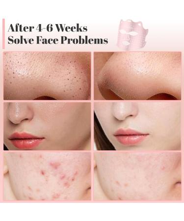 Red Light Therapy Mask | Blue Revive LED Face Mask for At-Home Light Therapy | 7 Color LED Facial Treatment - Buy Online on GoSupps.com