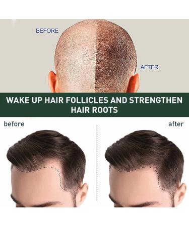  Stronrive Hair Growth Oil Hair Growth Strengthening Oil Hair Growth Oil Natural Growth Care Oil Nourishing Care for Stronrive Ends - Buy Online on GoSupps.com
