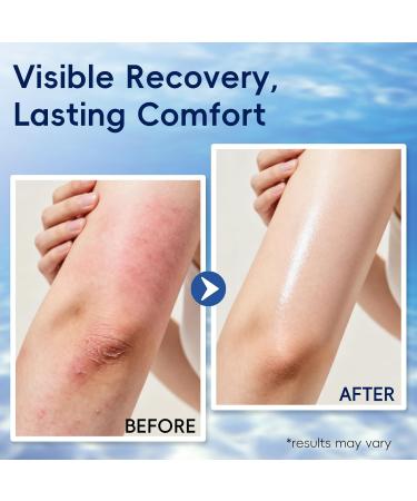 Natural Soothing Eczema Cream Eczema Relief Cream with Sea Moss Aloe Vera Oats Full Body Moisturizing Lotion for Sensitive & Dry Skin (5 Oz) - Buy Online on GoSupps.com