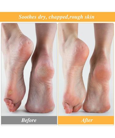 5 Pairs Foot Moisturizer Socks Moisturizing Socks Overnight Cotton Spa Socks for Cracked Heel Repair Gel Spa Moisturizing Socks for Women and Men White - Buy Online on GoSupps.com