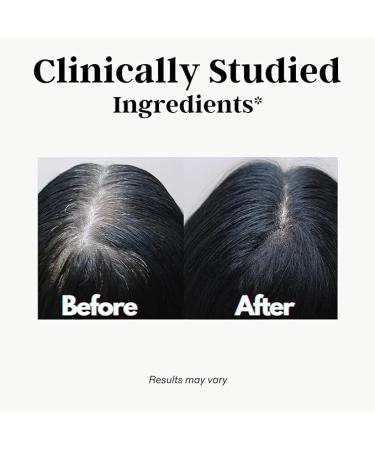 Gray Hair Rescind with Catalase - Anti-Gray Hair Supplements for Men and Women - Biotin  Saw Palmetto  Antiaging - Restore Natural Hair Color and Reverse Gray Hair - Buy Online on GoSupps.com