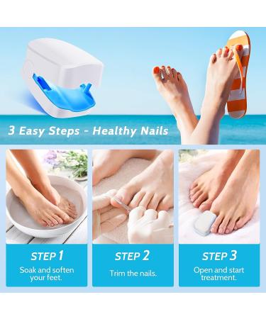 Incley Nail Fungus Cleaning Laser Device - Effective Blue Light Therapy for Toenails & Onychomycosis - Rechargeable Fungus Remover for Home Use - Buy Online on GoSupps.com