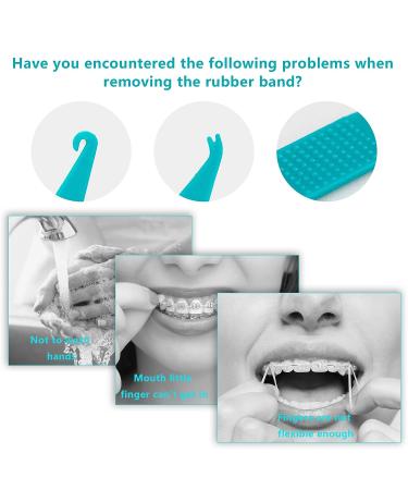 LOVEWEE Dental Elastic Bands Placers for Braces - 20PCS Disposable Orthodontic Placers - Multi-color - Pack of 1 - Buy Online on GoSupps.com