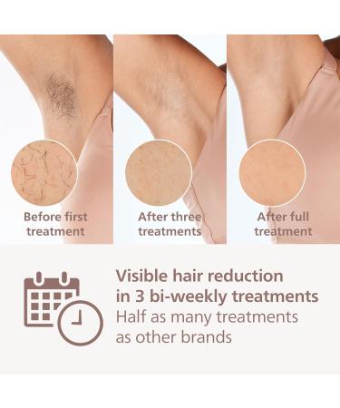 Philips Lumea IPL Hair Removal 9000 Series - Hair Removal Device with SenseIQ Technology 4 Attachments Body Face Bikini and Underarm Cordless Use (Model BRI957/00) Lumea 9000 Series 4 Attachments - Buy Online on GoSupps.com