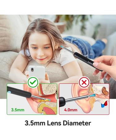 R1 Earwax Remover Tool with 1080P HD Camera and Wireless Connectivity - Ear Wax Removal Kit for iPhone and Android - Buy Online on GoSupps.com