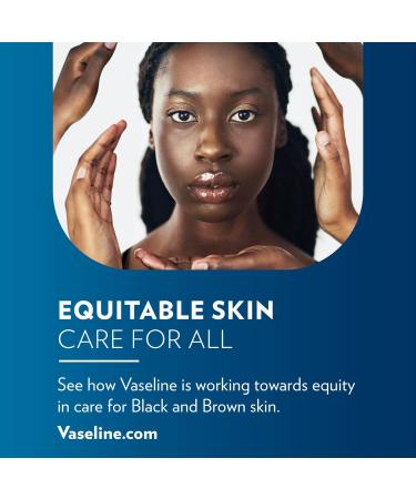 Buy 12 x Vaseline Lip Therapy Tin 20g Original - Moisturizing Lip Care - International Shipping Available - Buy Online on GoSupps.com