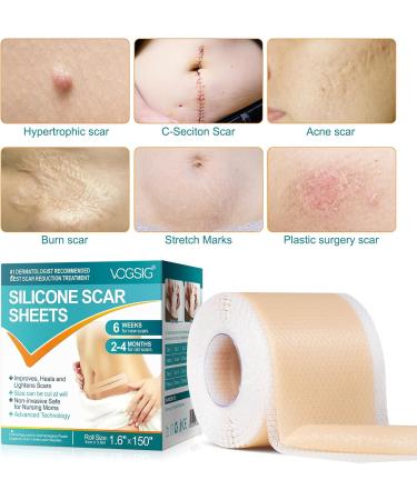 VOGSIG - Silicone Scar Sheets 1.6” x 150” Silicone Scar Tape - Buy Online on GoSupps.com