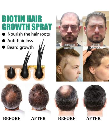  EXQST Blusoms Hair Loss Gel Blusoms Master Natural Herbal Liquid Hair Loss Gel - Buy Online on GoSupps.com