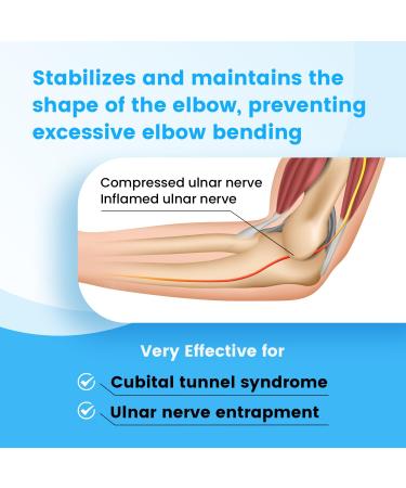 Ulnaris Elbow Rail for Cubital Tunnel Syndrome | Adjustable Orthosis for Night & Day - S/M Size | Left & Right Arm Support - Buy Online on GoSupps.com