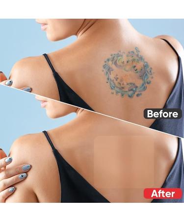 Invisible Waterproof Tattoo Cover Up Tape for Scar  Birthmarks - Buy Now - Buy Online on GoSupps.com