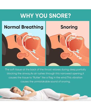 Anti-Snoring Mouth Guard - Comfortable & Adjustable Snore Device for Men/Women - Buy Online on GoSupps.com
