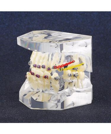 Orthodontic Tooth Model for Brackets & Wire Chain - Ideal for Dental Treatment & Training - Buy Online on GoSupps.com