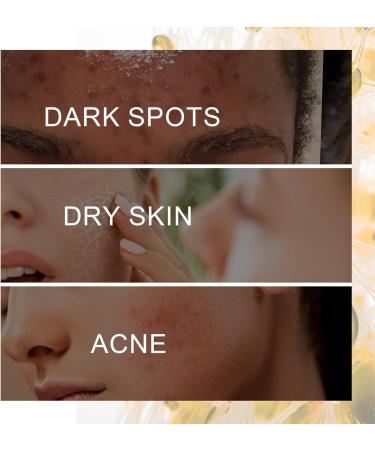 Tranexamic Acid Serum Tranexamic Acid Skin Brightening Serum Dark Spot Correcting Glow Serum Moisturiser For Acne Prone Skin with Hyaluronic Acid Arbutin Hyperpigmentation and Even Skin Tone - Buy Online on GoSupps.com