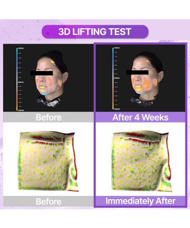 BIOHEAL BOH Probioderm 3D Lifting Essential Toner 5.07 fl oz (150 ml) | Hydrating & Lifting Face Toner with 17-Peptide Complex for Firmness & Elasticity - Buy Online on GoSupps.com