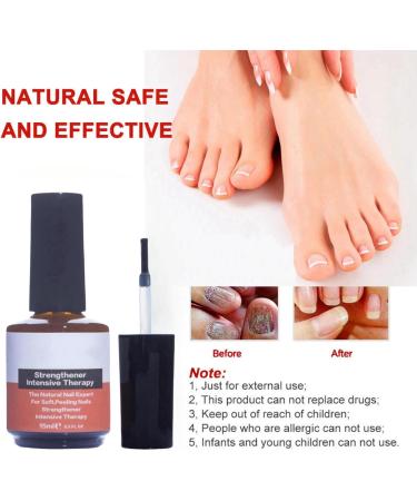 Nail Strengthening Treatment for Damaged Nails Nail Polish Strengthener Nail Hardner Oil Clear Nail Polish Strengthening Nail Growth and Strengthener Extreme Strength Nail Serum Nail Repair Serum - Buy Online on GoSupps.com