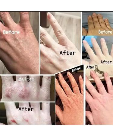 Kojic Acid Hand Cream Kojic Acid Cream Kojic Acid Cream for Hands Moisturizing Nourishing Hydrating Hand Creams Improve Dry Smoothing Skin Beauty Hands Winter Skin Care (3) - Buy Online on GoSupps.com