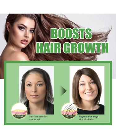 Castor Oil for Hair - Castor Oil Cold Pressed | Natural Hair Growth Oil with Castor | Strengthening Nourishing Hair Regrowth Oil | Hair Thickening Oil 30ml Promotes Longer Thicker Hair - Buy Online on GoSupps.com