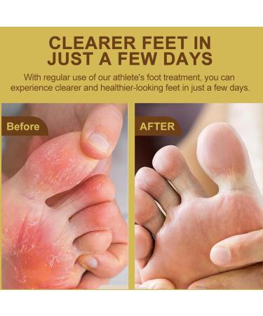 2PC Nutrition Foot Cream Foot Deodorant Cream for Odour Skin Therapy Cream Itching Sweating Scaling and Blisters Refreshing Soothing and Calming Convient Aussi Bien aux Hommes Qu'aux Femmes - Buy Online on GoSupps.com