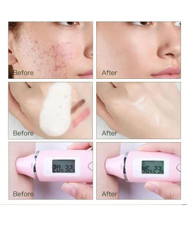  bellv Foaming facial cleanser with vitamin C powerful and brightening facial cleanser - Facial cleanser for most skin types - Facial cleanser for women - Buy Online on GoSupps.com