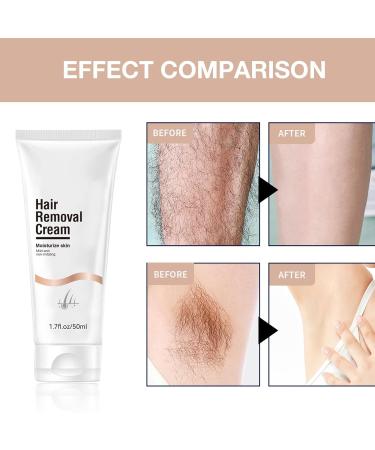 Hair Removal Cream for Women & Men - Painless Bikini Gel & Soothing Lotion for Unwanted Hair (3pcs) - International Shipping Available - Buy Online on GoSupps.com