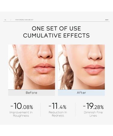 Hyaluronic Acid Skincare Set Hydrating Facial Kit Multi-Effect Moisturizing Skin Care Sets & Kits Skincare Gift Set With Serum Eye Cream Face Cream Moisturiser Face Women Skin Care - Buy Online on GoSupps.com