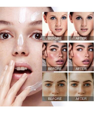 Fade Stain Beauty Cream Freckle Remover Cream Dark Spot Remover for Face Dark Spot Correcting Glow Serum Dark Spots Remover Dark Spot Corrector Cream Age Spot Remover Dark Spot Cream Spot Remover - Buy Online on GoSupps.com