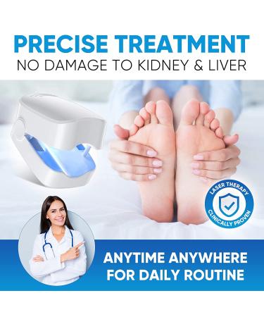 Advanced Nail Fungus Cleaning Laser Treatment Device - Home Use Toenail Therapy - Buy Online on GoSupps.com