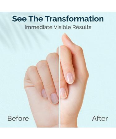 Shea Nourishing Cuticle & Nail Cream | USA Made Pro Nail Care | Strengthen Nails & Soften Cuticles | Hydrating Repair with Organic Shea Butter | 1 Oz - Buy Online on GoSupps.com