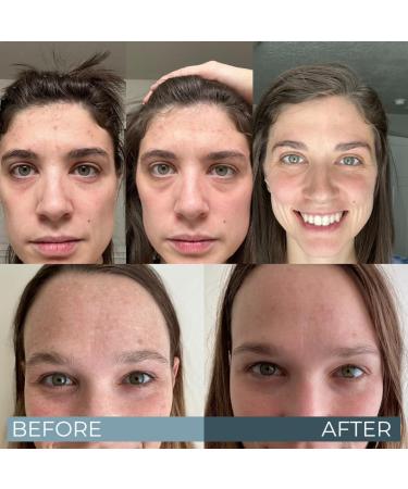 PURIFY Premium Oil Cleanser - Fragrance-Free Facial Cleansing Oil | Makeup Remover for All Skin Types | Reduces Oily Skin & Cleanses Without Clogging Pores - Buy Online on GoSupps.com