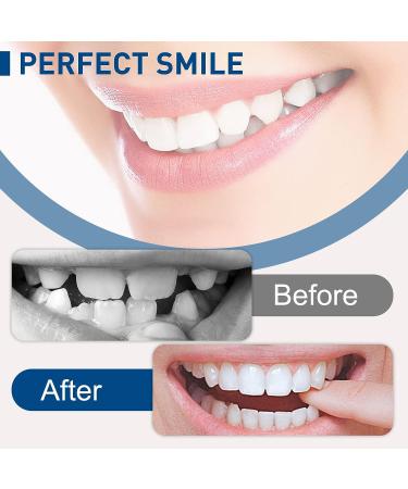 2 Pairs Snap on Dentures & Veneers with Box - Temporary Braces Cover for Imperfect Smile - Buy Online on GoSupps.com
