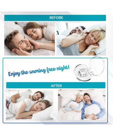 Skyloa Anti Snoring Devices - Stop Snoring and Sleep Better - Buy Online on GoSupps.com