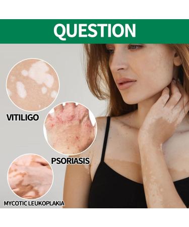  Bexdug Cream | 20 herbal ointments Moisturizing cream for skin leukoplakia white spots on the skin - Buy Online on GoSupps.com