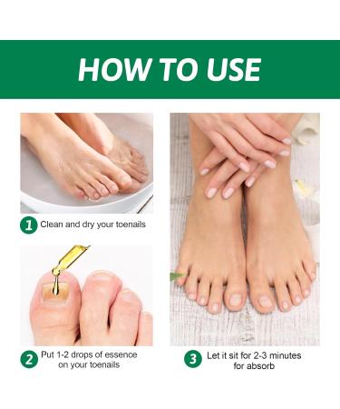 Fungal Nail Treatment Nail Repair Treatment Toenail Fungus Treatment Restores Healthy Nails for Thickening Yellow-Brown Discoloration Repair for Fingernails 30ml transparent - Buy Online on GoSupps.com