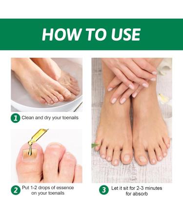 30ml Fast-Acting Toenails Treatment - Strengthen & Protect Brittle Nails | No Filing Needed - Buy Online on GoSupps.com